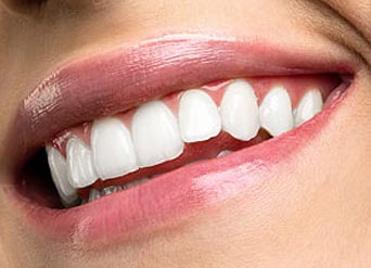 4 Reasons To Pick In-Office Teeth Whitening | Moreno Valley