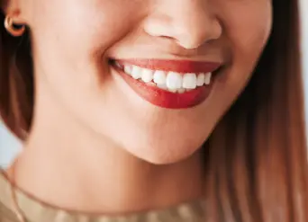 Five Common Questions About Teeth Whitening in Moreno Valley Five Common Questions About Teeth Whitening in Moreno Valley